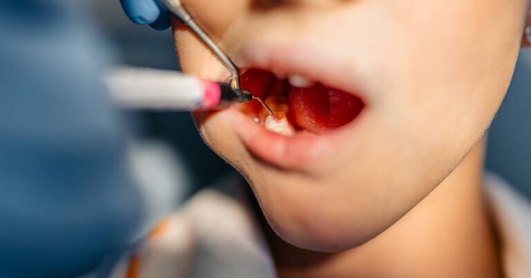 Primeira ida ao dentista ocorre apenas aos 7 anos no Brasil, mostra levantamento